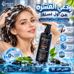 شامبو علاج القشره